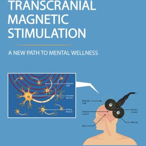 Transcranial Magnetic Simulation